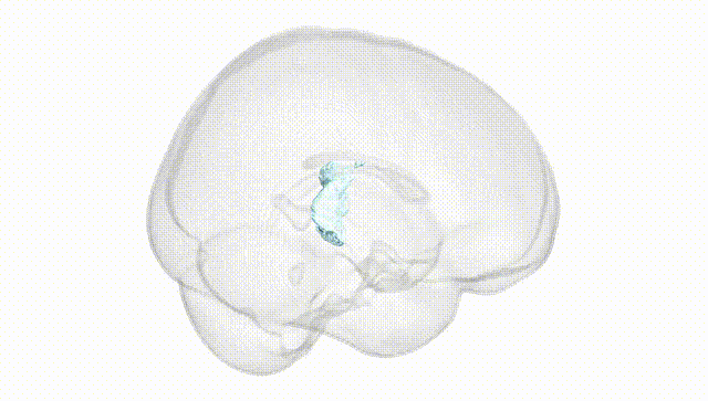 Full Brain White